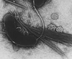 Холерный вибрион - фоография под микроскопом